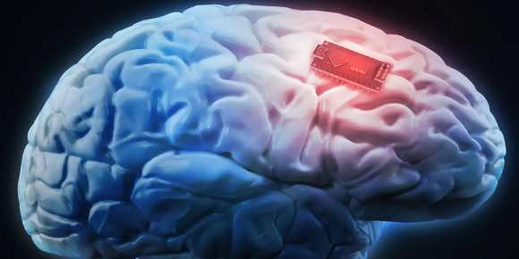Synchron logra colocar un chip en cerebro humano, Neuralink de Elon Musk se queda atrás con el adelanto