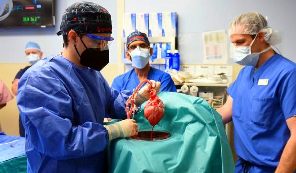 Revela autopsia que el corazón de cerdo trasplantado a un hombre estaba infectado por un virus