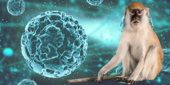 Lo que sabemos del primer caso de viruela del mono en México
